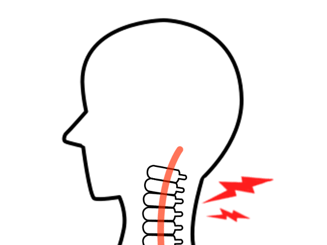 交通事故で頚椎捻挫と診断された…。症状や治療方法について解説！ | 交通事故病院