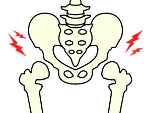 追突事故で股関節に痛み…考えられる症状や後遺障害等級を解説！