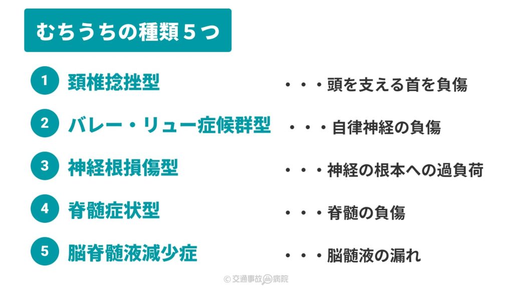 むちうちの５つの種類と違い