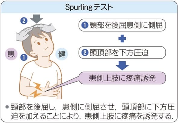 スパーリングテスト