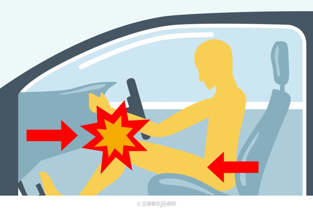 ダッシュボード損傷